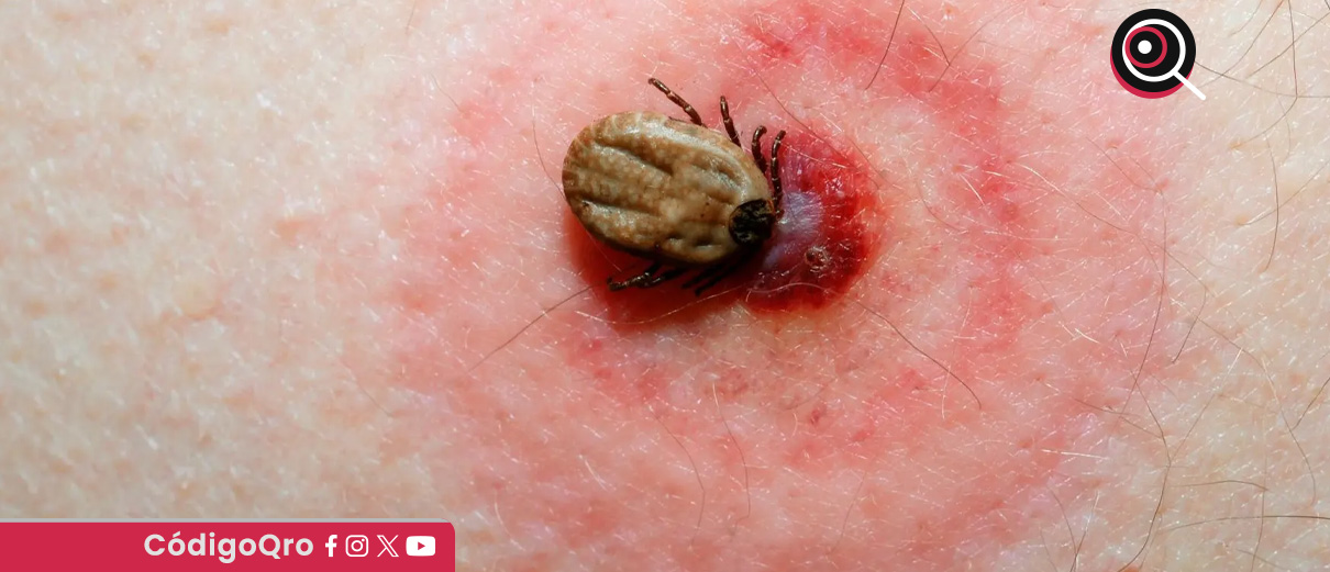 enfermedad de Lyme
