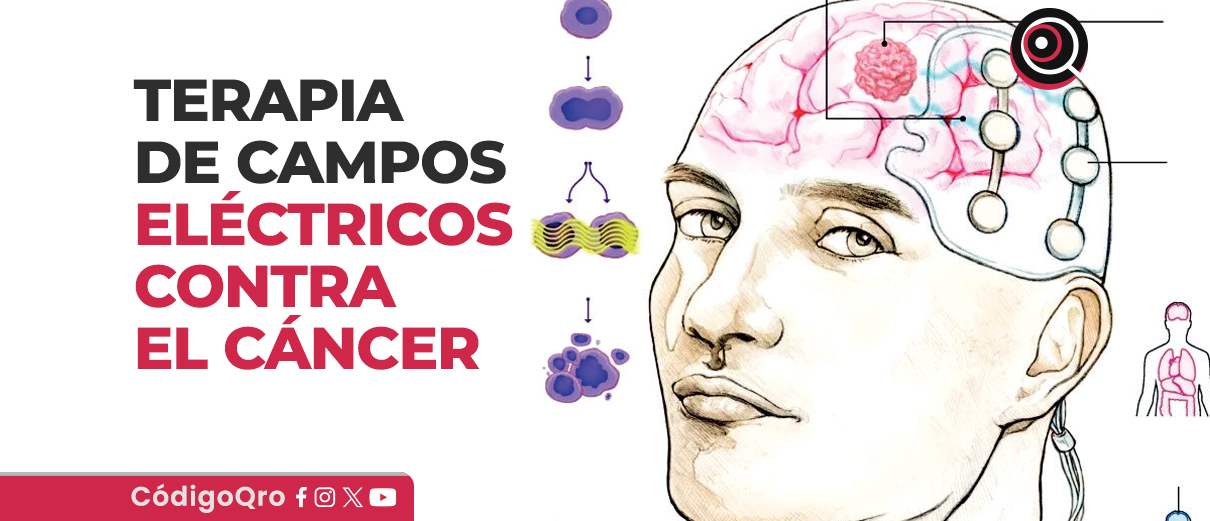 Terapia de campos eléctricos contra el cáncer