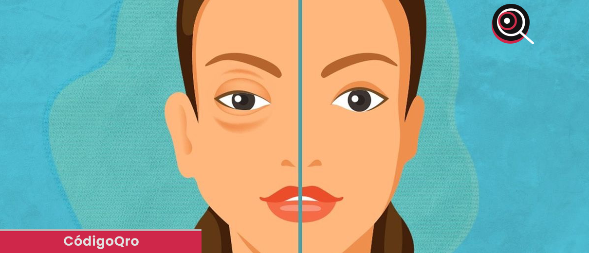 Sesa, Día Mundial, Angioedema Hereditario,