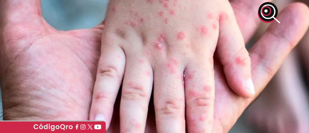 Habilitan sitio web para ubicar centros de vacunación, ante brote de sarampión